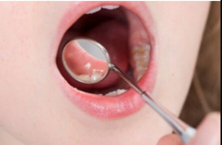 深圳哪家醫(yī)院做豐胸手術(shù)效果好？