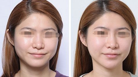 深度調(diào)研，專業(yè)精選！揭秘廣州脫發(fā)治療院所，實(shí)力派機(jī)構(gòu)紛紛入選！