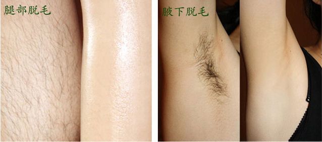 佛山市私密整形醫(yī)院哪家口碑好？