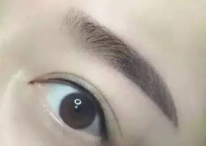 重慶自體豐胸去哪里找？重慶自體豐胸哪家醫(yī)院好？