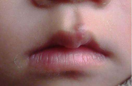 濟南哪家醫(yī)院做玻尿酸好？選擇時要注意這幾個關(guān)鍵點