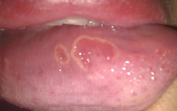 2023年上海最具聲譽(yù)的硅膠膨體植入隆鼻整形醫(yī)院排名前10！