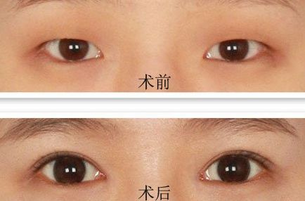 蘇州科技城醫(yī)院、蘇大附一醫(yī)院整形口碑價格一覽，一鍵查詢！