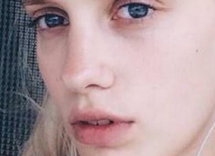 具惠善整容：探索明星整容現(xiàn)象背后的觀念轉(zhuǎn)變與社會影響