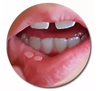 鄭州botox醫(yī)院哪家好？比較專業(yè)的botox醫(yī)院排行榜有哪些？