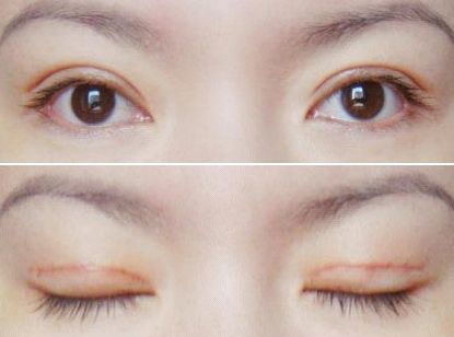 2023年西安受歡迎的整形醫(yī)院推薦！教你選擇靠譜醫(yī)美機(jī)構(gòu)