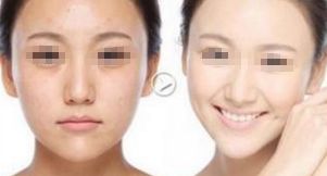 合肥鼻整形醫(yī)院排行榜發(fā)布！推薦醫(yī)療機(jī)構(gòu)華美、安徽省立醫(yī)院、藝星