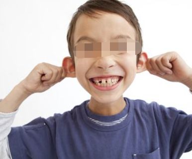 夏文森鼻整形技術(shù)解析，醫(yī)生的專業(yè)程度如何