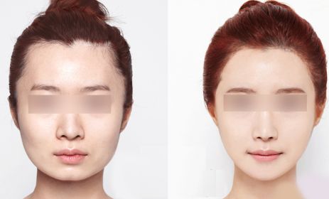 成都深層清潔：揭秘醫(yī)療整形前十醫(yī)院榜單