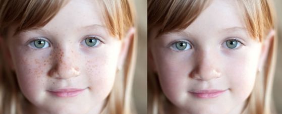 上海隆鼻哪位醫(yī)生比較好？推薦十位專家，陳付國(guó)、王會(huì)勇、邱文苑等匯集！