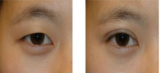 重慶生物注射瘦小腿技術(shù)排行榜TOP10全解析！