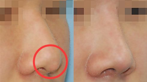 臺州太陽穴凹陷填充：盤點(diǎn)10位經(jīng)驗(yàn)豐富的整形醫(yī)生