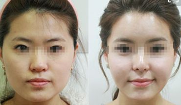 東莞韓式定位雙眼皮 10 家匠心整形醫(yī)院大盤點(diǎn)