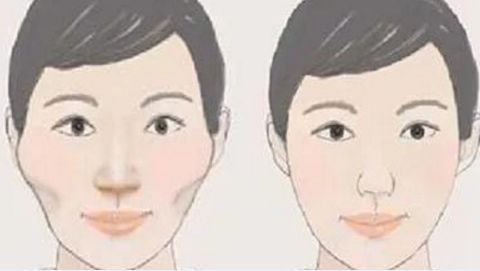 濟寧哪家醫(yī)院割雙眼皮效果好？排名第一的是哪家