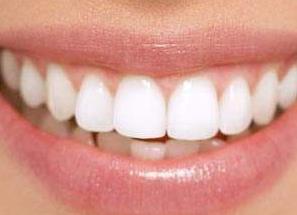 東莞新生醫(yī)院植發(fā)效果如何？東莞新生醫(yī)院植發(fā)能不能幫助恢復(fù)發(fā)際線？