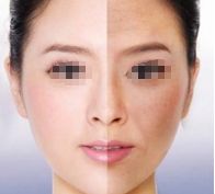 懷化解決頸紋的醫(yī)院排行榜