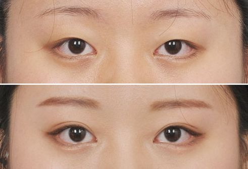 昆明私密整形哪家口碑好，全面解析昆明私密整形醫(yī)院排名和用戶評(píng)價(jià)