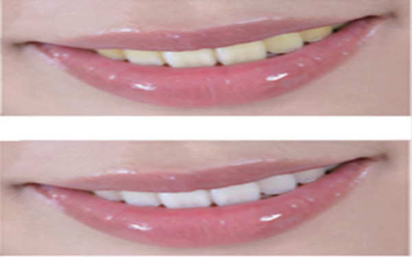 大慶市哪些整形醫(yī)院可靠？2023非常受歡迎的法令紋微創(chuàng)提升醫(yī)療機(jī)構(gòu)排行前十!