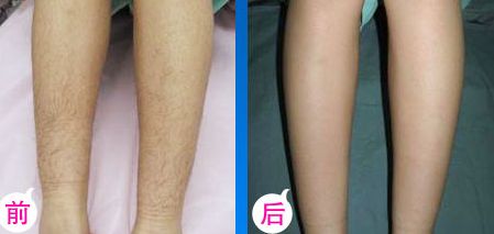 深圳哪家醫(yī)院做臉型整形好