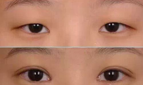 上海哪家醫(yī)院干細胞去細紋整形性價比高？2023年十強口碑榜揭曉！