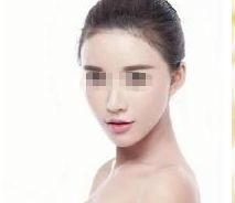 大連臉頰玻尿酸填充醫(yī)院推薦排行榜