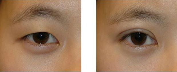 成都注射除皺正規(guī)整形醫(yī)院口碑排名對(duì)比