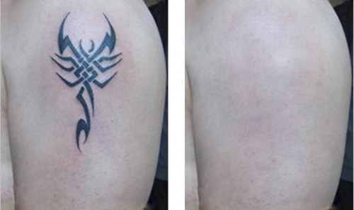 整形失敗事件大揭秘：你會(huì)冒險(xiǎn)在美容院動(dòng)刀嗎？