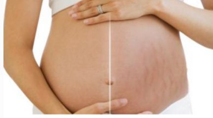 如何選擇保定市治療鼻子疾病最好的醫(yī)院？