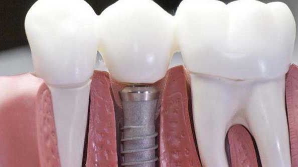 南京最新祛疤產(chǎn)品哪家好？一文詳解南京地區(qū)最適合的祛疤產(chǎn)品推薦