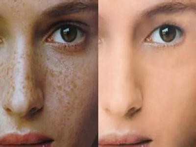 2023年武漢醫(yī)療機(jī)構(gòu)排行榜揭曉！探究光纖溶脂瘦臀部美容醫(yī)院的絕佳選擇。