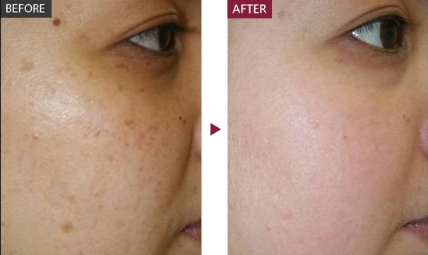 【上海抽脂減肥哪家醫(yī)院好】專業(yè)大型醫(yī)療機(jī)構(gòu)推薦，值得信賴！