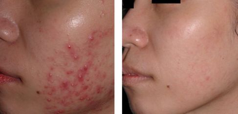 沈陽有哪些知名整形醫(yī)院？公立和私立機構(gòu)齊備！