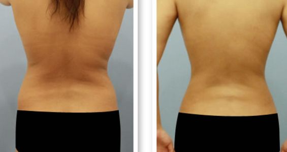 長(zhǎng)春切包皮哪家醫(yī)院好？專家推薦的長(zhǎng)春男科醫(yī)院排名及費(fèi)用解析