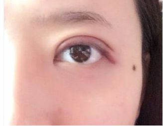 荊州整容哪家醫(yī)院好？