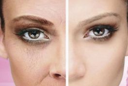 淄博哪家整形醫(yī)院的祛眼袋效果最佳，體驗(yàn)口碑推薦！