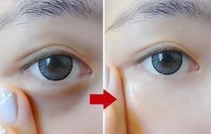 蘇州皮秒激光醫(yī)院哪家好？如何選擇適合自己的蘇州皮秒激光醫(yī)院