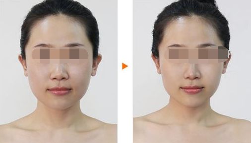 武漢包皮手術(shù)哪家醫(yī)院好？排行榜前十強(qiáng)推薦！