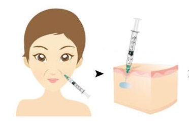 佛山專業(yè)整形醫(yī)院排行榜：解決背部動氧瘦問題，快速速覽！