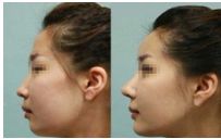 常州哪家整形外科醫(yī)院做鼻子好？這三家給出新答案