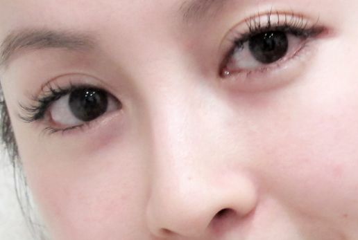 深圳口碑領(lǐng)先的黃褐斑祛除醫(yī)療整形醫(yī)院前十名