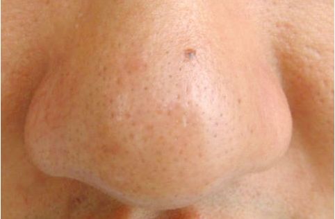 大同哪家醫(yī)院治燒傷好？專注燒傷治療的大同醫(yī)院推薦