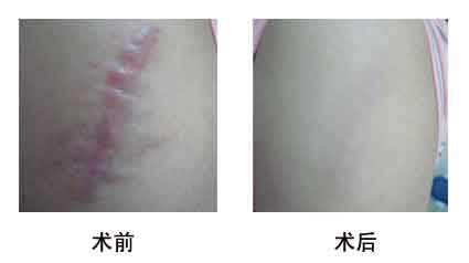 2023年北京納米脂肪面部年輕化領(lǐng)先的十大美容醫(yī)院評(píng)選出爐！