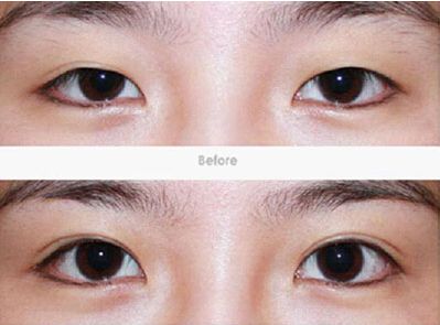 精選！廣州有哪些值得推薦的大型整形醫(yī)院？