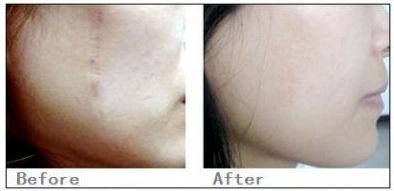 海南眼部皺紋去除醫(yī)院排行榜發(fā)布：前10家醫(yī)院盤點