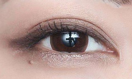 崔貞媛整容手術(shù)后的新容貌驚艷眾人，獲得廣泛贊譽(yù)！