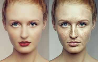 湘潭哪些醫(yī)院的隆鼻技術(shù)值得選擇？