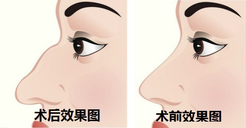 昆明美伊萊醫(yī)療美容門診部的醫(yī)生技術(shù)好嗎？他們擅長(zhǎng)哪些項(xiàng)目推薦？