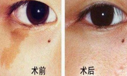 南京正規(guī)美容醫(yī)院哪家好？選擇正規(guī)美容機構(gòu)需注意的幾個關(guān)鍵點