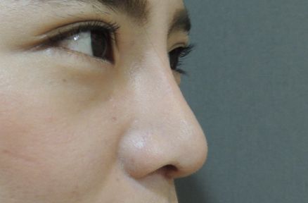 遼陽(yáng)鼻子問(wèn)題?？漆t(yī)院有哪些？哪家醫(yī)院看鼻子好？