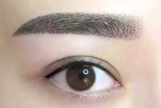 劉雨欣整容了嗎？揭秘真相及整形手術(shù)常見誤區(qū)